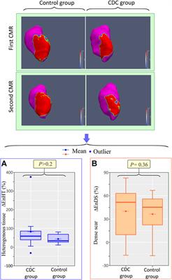 Intrapericardial cardiosphere-derived cells hinder epicardial dense scar expansion and promote electrical homogeneity in a porcine post-infarction model